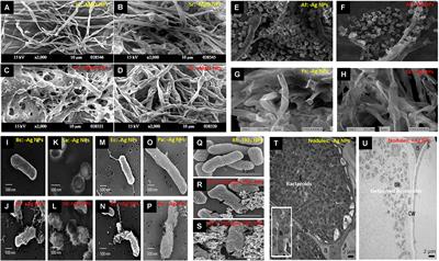 Are Nanoparticles a Threat to Mycorrhizal and Rhizobial Symbioses? A Critical Review